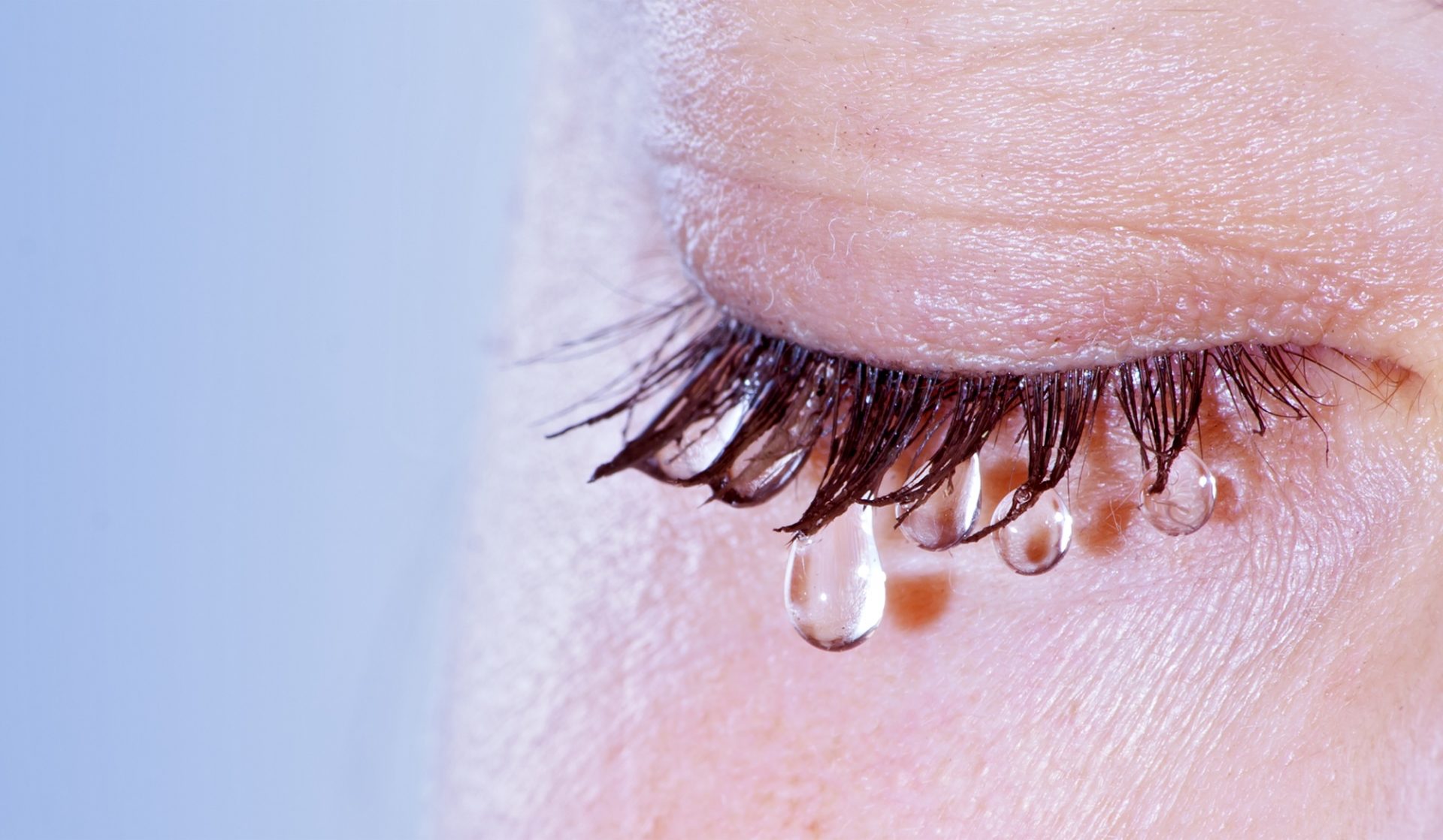 Homeopatia para olho seco: Síndrome dos olhos seco e a qualidade das lágrimas